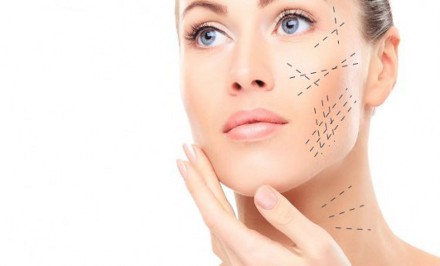 Izomtónus fokozó, bőrfeltöltő EMS kezelés arcon és nyakon hialuronsavval és kollagénnel kupon