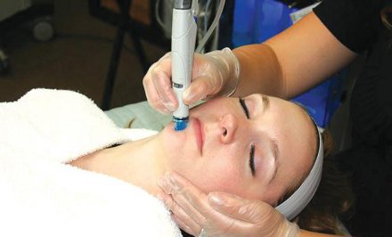 Hidra Facial mélytisztítás bőrmegújítással, a legújabb oxigénes, vízsugaras AQUA Peel rendszerrel és hatóanyag kombinációval! kupon