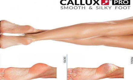 Callux frissitő vagy esztétikai pedikűr – fájdalommentes, gyümölcsmagvas bőrradírozással egybekötött wellness kezelés! kupon