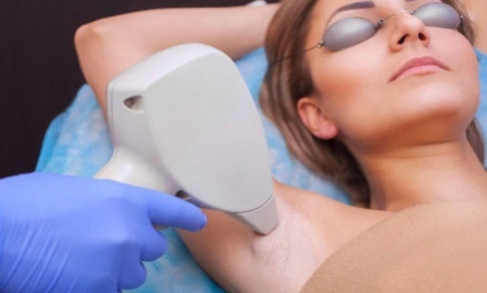 5 alkalmas valódi dióda lézeres szőrtelenítő bérlet professzionális géppel teljes intim és hónalj vagy teljes intim és farcsík területén! kupon