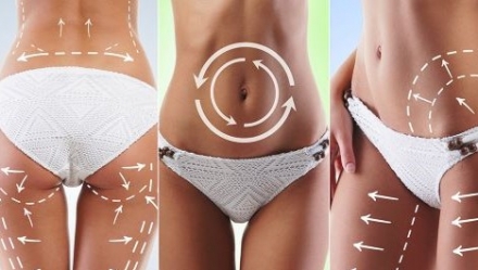 Liposonic Hifu Body fogyasztó és alakformáló kezelés több területen egyszerre! (has, derék, integetőizom ) kupon