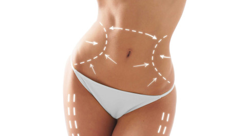 Zsírbontó és feszesítő csomag Liposonic Hifu Body Shape géppel és Multipoláris Rádiófrekvenciával belső combra vagy teljes fenék területén! kupon