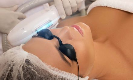 Teljes arcos sejtszintű bőrfiatalítás, rozácea és pigmentálódás kezelése photorejuvenációval,  IPL technológiával, fájdalommentesen! Plusz 30% kedvezmény érvédő mezoterápiára! kupon