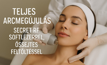 Teljes arcmegújulás: Secret RF Softlézerrel, Őssejtes feltöltéssel – a fiatalos ragyogás kulcsa! kupon