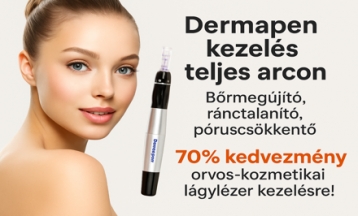 Bőrmegújítás magas szinten! Dermapen kezelés és 4D hyaluronsavakkal, simább, feszesebb, ragyogóbb arcbőr!  Plusz 70% kedvezmény lágylézertus regeneráló kezelésre! - akciós kupon