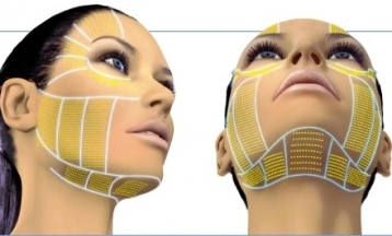anti aging fort myers