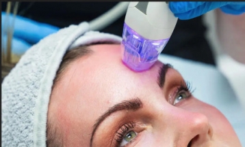 A leglátványosabb Secret Rf Frakcionált MicroneedleRF arcfiatalítás! Teljes arc kezelése Softlézeres aktiválással és tengeri DNA feltöltéssel, megoldás minden bőrproblémára!a! - akciós kupon