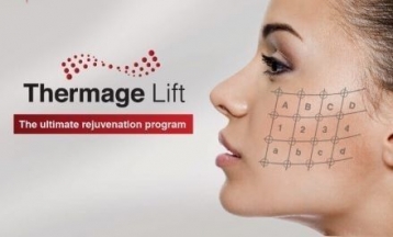 Thermage IV. mátrixpontos rádiófrekvenciás kollagénindukciós ránckezelés arcon, tokán, nyakon és dekoltázson, azonnal látható eredménnyel! Plusz 40% kedvezmény feszesítő MesoIlaser mezoterápiára! - akciós kupon
