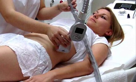 Alakformálás, fogyás, és cellulit kezelés, 1 alkalmas 4 az 1-ben VelaSlim technológiával bármely választott testrészen, plusz 80% kedvezmény kavitációs ultrahangra! kupon